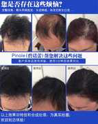 高档日本V-UP碳粉补发遮发际线粉假发神器男女增加头发密发纤维喷