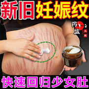 妊娠纹产后修复霜孕妇，紧致肚皮橄榄油专用预防消除淡化妊娠纹药膏