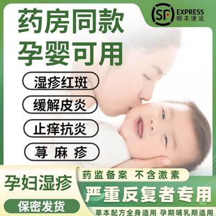 孕妇专用湿疹止痒无激素孕期哺乳期皮癣股藓皮炎膏名村AC