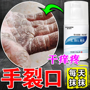 防裂膏手足干裂皲裂贴治脚后跟手指，干裂起硬皮开裂真菌感染修复霜