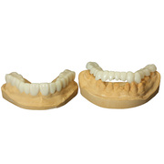 定制可脱卸牙套装饰美容牙齿神器四环素氟斑牙全瓷牙齿贴面