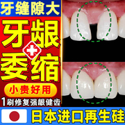 日本牙龈萎缩修复再生专用牙周炎牙齿松动膏医用