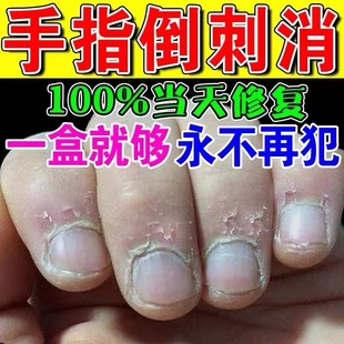 指甲修复液受损再生手指倒刺营养油护理去刺神器防儿童手上干裂脱