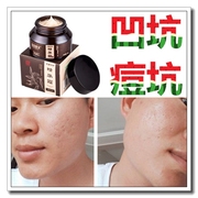 冻干粉祛男士痘印痘坑毛孔粗大淡化疤痕日本面膜，去女凹陷修复工具