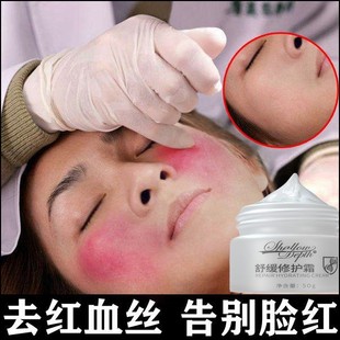 祛去红血丝修复去除脸部脸上过敏角质层改善泛红敏感肌皮肤修复霜