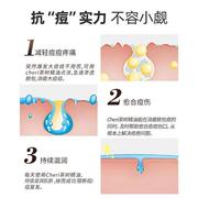 Cheri澳洲纯天然茶树精油精华30ml淡化痘印祛痘控油蚊虫叮咬止痒