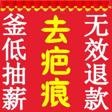 ��̺۲�Ʒȥ�̺��������̰���͹�̺��޸��ʸ������˰�ӡ������Ʒ