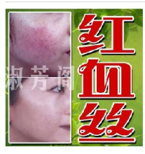 纯中药★专业去除红血丝修复霜 修复红血丝、过敏、痘印