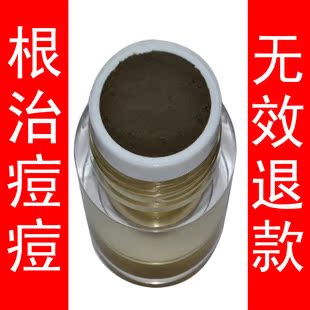 促销！郑老师100%纯中药祛痘产品 特效控油抗痘去印粉刺 无效退款