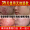上下架计划:拔毒膏祛痘青春痘痤疮粉刺女士去痘印无效退款男士祛痘产品前五强