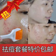 莉莉安美容院专用茶树去痘冰晶 痘痘/脓包/暗疮/粉刺/去印/退红/