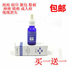 VEBE苇碧 青春痘成人痘痤疮 粉刺 脓包 控油 收缩毛孔 痘印 包邮