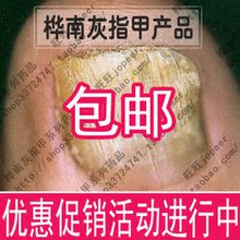 灰指甲专用 桦南灰指甲修护液 万千好评 快速特效 买1瓶药包邮油