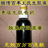 王氏奇药治愈严重褥疮膏 药 老烂腿烧伤烫伤效果神速 收费最低