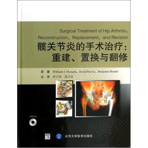 髋关节炎的手术治疗--重建置换与翻修(附光盘)(精) (美)|ruв категории книги/журнал/газета, медицинского здравоохранения, медицины других - от Buy2taobao.com для оказания профессиональной услуги покупки агента Taobao