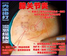 内家秘宝 湿邪提拔液 风湿骨质增生颈椎病特效 药肩周炎腰腿痛