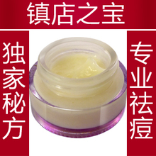 俪草堂中药祛痘霜 深度去痘痘热卖产品 青春痘 粉刺 痤疮膏 暗疮