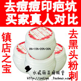 包邮水妮丽亚果酸换肤霜去痘印凹洞祛痘印祛痘疤痘坑去黑头粉刺