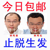 包邮 止脱 生发 密发 斑秃 掉头发 脱发 长头发 全秃 脂溢性脱发