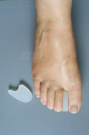 Imported adult children silica gel Sub-toe Overlapping toes thumb Eversion correct Large blackmailed Dailyin the Personal Care/Health/Massage equipment , Home health care equipment , Health protectors(Waist/Knee/Leg) category - from Buy2taobao.com to provide professional Taobao agent buy service
