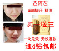 包邮无效退款 正品代谢毒素强效瘦脸紧致提升刮痧精油脂肪肌肉型