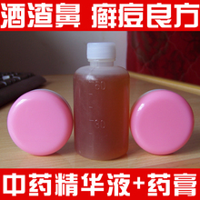 民间奇方|酒渣鼻|酒糟鼻|红鼻子|红血丝|毛囊炎|祛癣痘|二盒一瓶