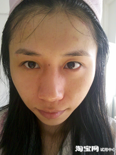 迟来的报告~黛依美雷涛祛痘效果好!_春冬