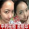 上下架计划:中药祛痘液 去痤疮脓包粉刺青春痘痘杀菌消炎水去痘 祛痘男女产品