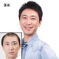 秃顶补发块-顶头发稀少白发真发片贝丝特手织