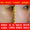 上下架计划:红白瓶中药美白祛斑霜雀斑无效退款淡斑去斑霜特效产品日晚霜正品