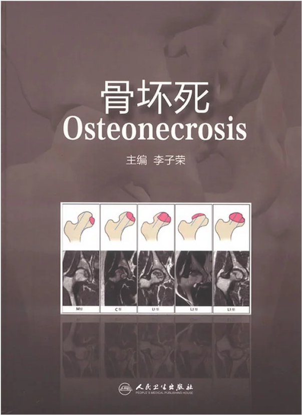 正版包邮现货 《骨坏死》 李子荣主编 9787117167291 人民卫生出版社 正版 外科学 骨科9787117167291在类目 书籍/杂志/报纸, 低于5元专区, 医学中 - 来自Buy2taobao.com提供专业的淘宝代购服务