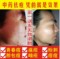 上下架计划:特效去痘霜中药祛痘产品前五强女男士套装去痘印痘疤凹洞无效退款