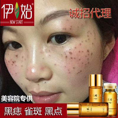 正品美容金水去痣点痣药水祛痣膏无痕除痣灵痦