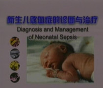 EKX027 新生儿败血症的诊断与治疗 卫生部医学视听教材 价格:2.50