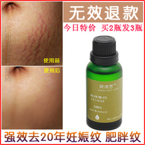 辰五羊孕妇橄榄油护肤品<em>产后</em>消除<em>妊娠纹</em>/预防