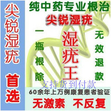 口腔咽喉尖锐湿疣_然而在潜伏期的时候便是治疗口腔尖锐湿疣最好
