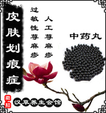 【划痕性荨麻疹】最新最全划痕性荨麻疹 产品