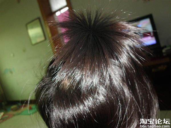 【宝妈求教】女宝快2岁了,<em>头发硬是</em>不肯长,是