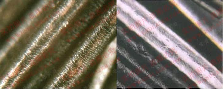 500万相素USB电脑型毛发<em>头发毛囊</em>发质毛发检