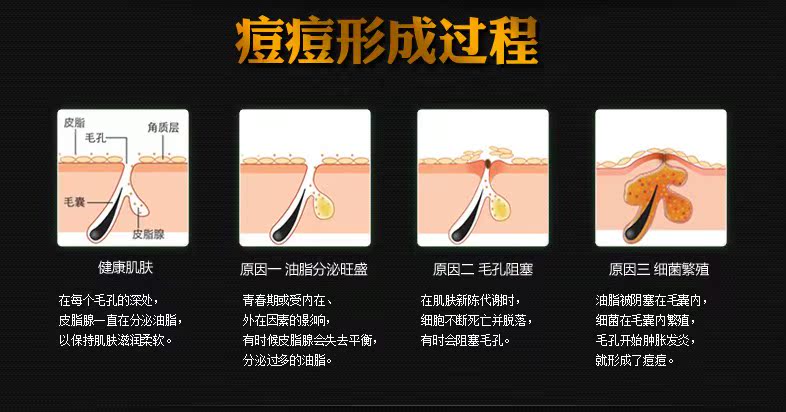 三黄祛痤疮精华原液 OEM/ODM化妆品加工