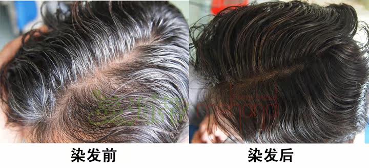 老人白发多选择植物<em>染发</em>粉<em>好吗</em> 哪种植物<em>染发</em>