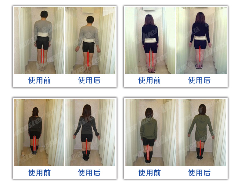 O型腿矫正带直腿带 腿型矫正带 儿童腿部矫正