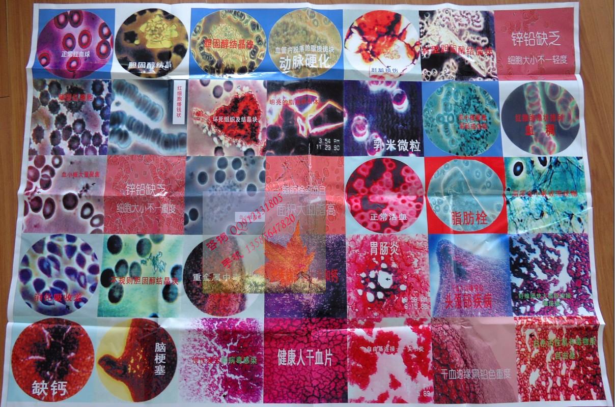 显微镜-电脑电视两用一滴血双目显微镜黑背景