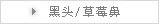 去角质/黑头/草莓鼻
