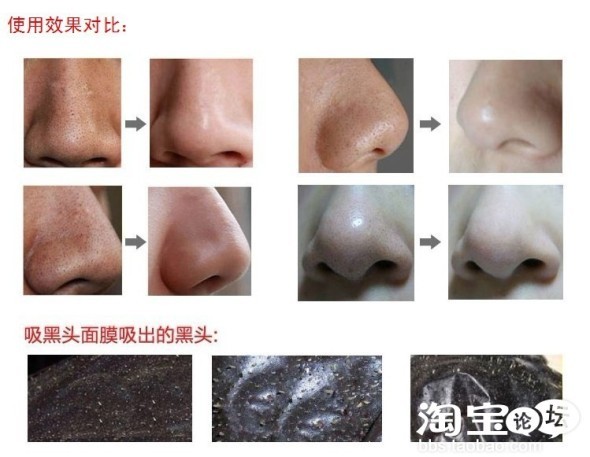 【网友晒货】李医生吸黑头面膜套装 去黑头鼻